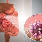 Çfarë është gastroenteriti viral ose gripi i stomakut?