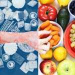 Psoriasis: Ushqimet që duhet të hani dhe të shmangni nëse keni psoriasis