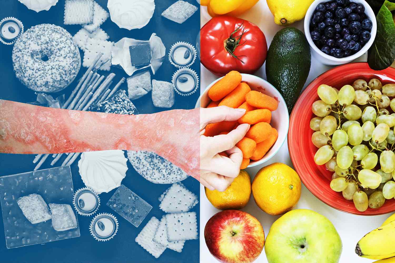 Psoriasis: Ushqimet që duhet të hani dhe të shmangni nëse keni psoriasis